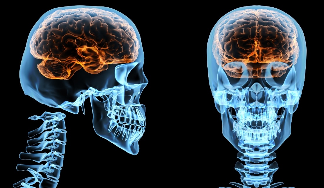 insan beyni kafatasi Karmaşık ve Gizemli Organımız<br>Beyin